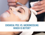 Chemical Peels vs. Microneedling: Which Is Better for Acne Scars