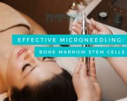 Effective Microneedling: Bone Marrow Stem Cells