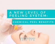 Chemical Peel Benefits