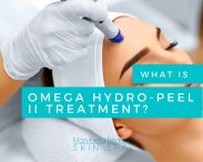 Omega Hydro-Peel II Treatment